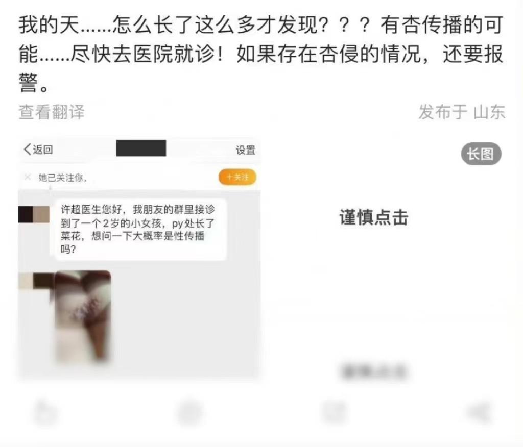 2岁女童患尖锐湿疣，臀部长满“菜花”？患病真相到底是什么？