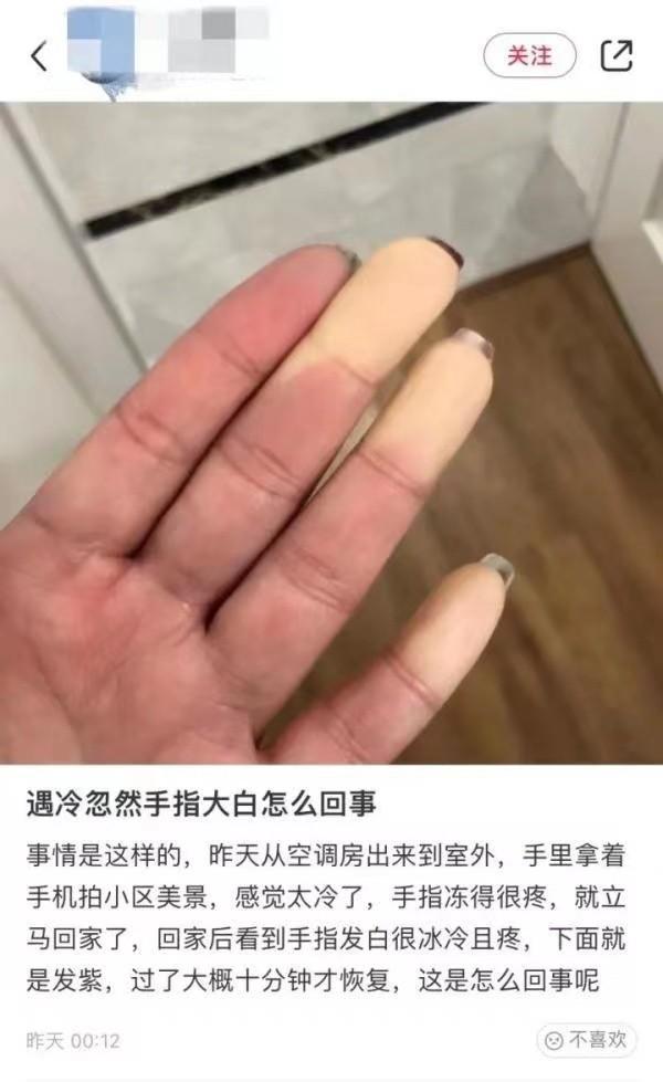 手指遇冷发白是冻伤？极易被忽视的雷诺综合症，有人因此截肢保命