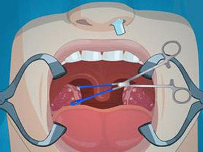 扁桃体发炎不要轻视，严重时连累心脏和肾！这些情况必须要切除