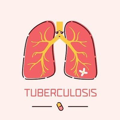 22人感染43人筛查异常，这种病看起来像咳嗽，却是乙类传染病