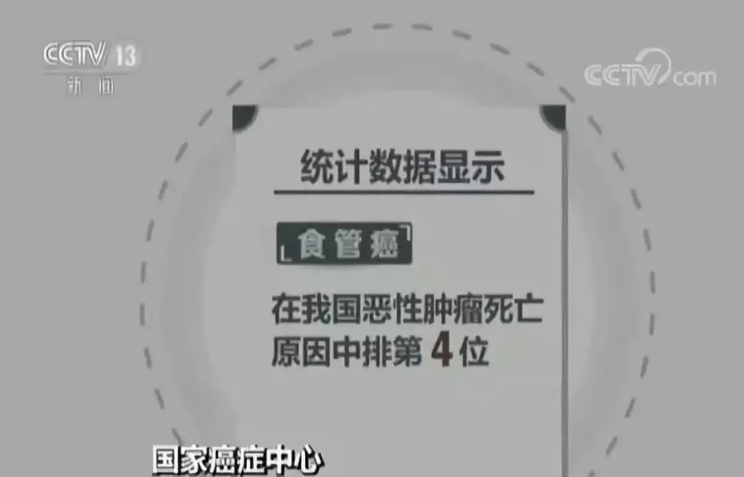 一家三代患食管癌！多种癌和饮食习惯有关，你的饮食习惯中招了吗