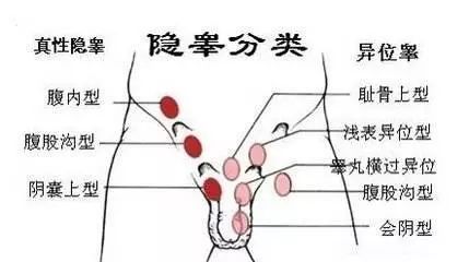 #清风计划#男孩家长都要重视的检查，孩子“蛋蛋”到底在不在？