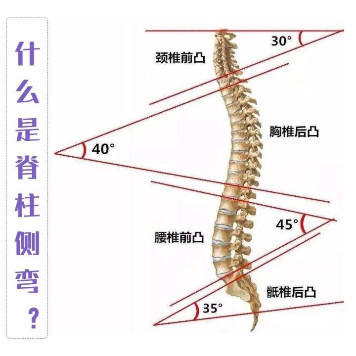 #清风计划#  孩子有点驼背？小心！这很可能是脊柱侧弯！