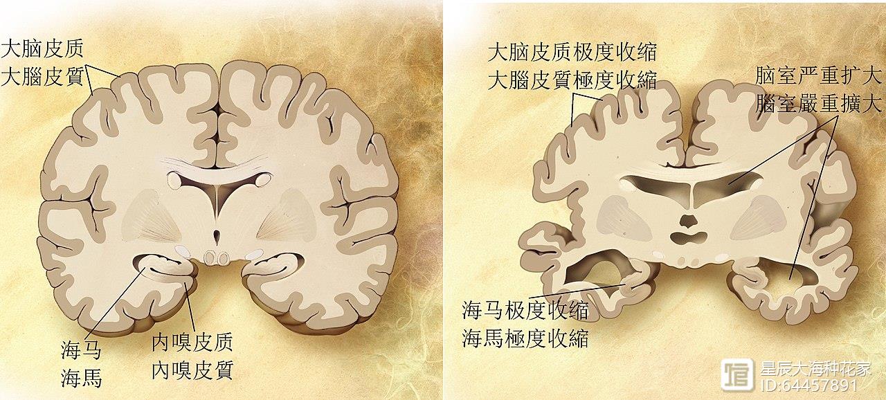 不干正事的伟哥，科学家说它可以预防痴呆！各位是否要预防一下？