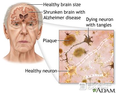 不干正事的伟哥，科学家说它可以预防痴呆！各位是否要预防一下？