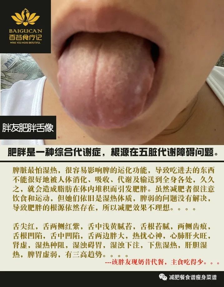 ​【肥胖舌诊5】~胖只是表面，成功减肥要找到肥胖的内在根源