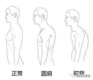 教你几个动作，改善圆肩驼背头前伸，不再为体态问题困扰