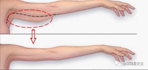 蝴蝶臂太明显？肚子上的赘肉也明显？这里有详细的减肥教程