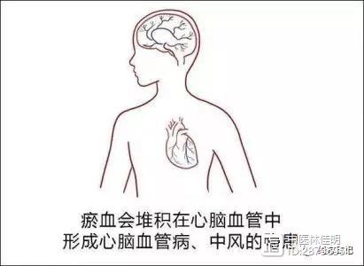 脑病时间丨脑病科 什么是脑栓血形成？