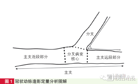 阜外医院窦克非：介入治疗分叉病变预测分支闭塞有章可循