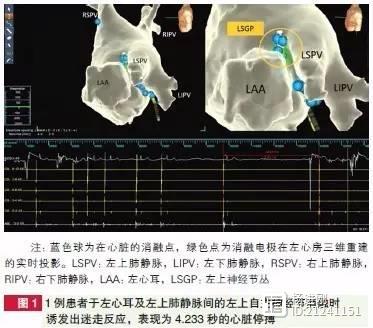 阜外医院姚焰等：血管迷走性晕厥也可射频消融治疗