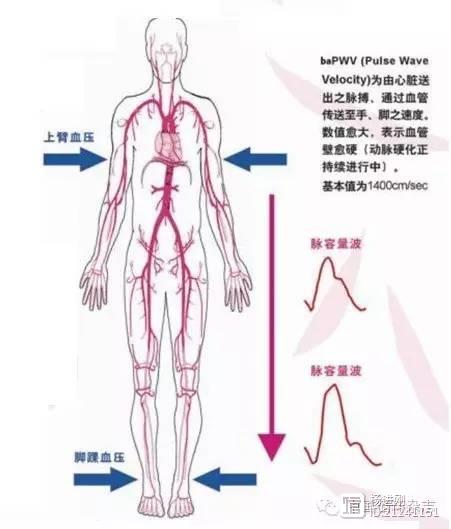 【CSPPT亚组分析】动脉僵硬是中风“帮凶”