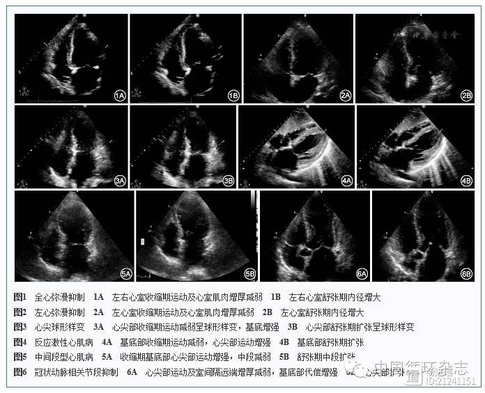 协和医院学者称：重症患者可出现全心弥漫性抑制