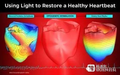 心律失常或能实现“光除颤”