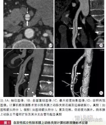 大连医大一院学者称，应关注肾动脉CT检查的意外发现