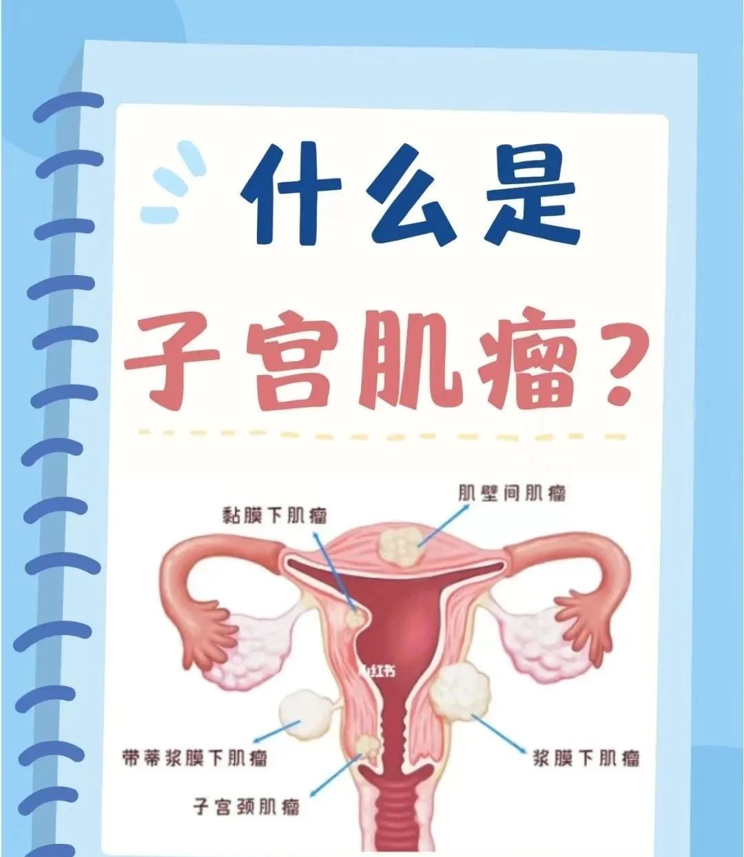 子宫肌瘤、输卵管积液、乳腺纤维瘤、子宫肌瘤、多囊卵巢综合征、妇科炎症等18种妇科病用药总结