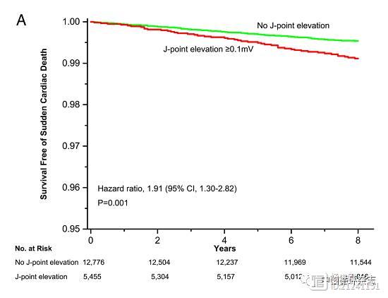 中山大学附一医院吴素华等在Heart杂志发文称，早复极可致冠心病高危人群心脏猝死风险增加近一倍