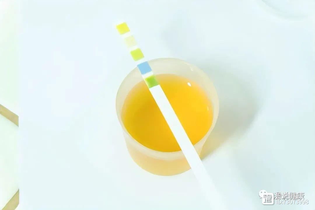 肾不好，尿液知？除了肾虚外，引起尿黄的原因还可能与这6点有关