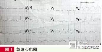 甘肃疑难病例：56岁女士突发意识丧失，ST段抬高但冠脉正常