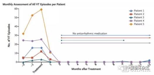 新英格兰医学杂志研究称，放疗或能治疗难治性室性心动过速