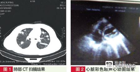 【病例报告】遇有不明原因发热要考虑这种病