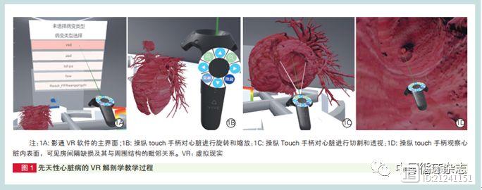 阜外医院开先河，使用虚拟现实技术培养心外医师