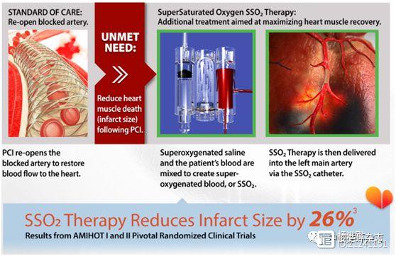 FDA批准过饱和氧治疗系统治疗“寡妇病变”——左前降支闭塞的急性ST段抬高型心梗