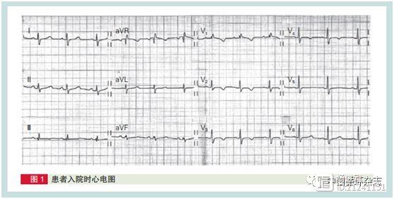 北大医院蹊跷病例：13岁学生一写作业就胸痛，这种病过去曾叫“假性心脏病”