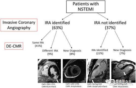 Circulation子刊研究称：识别NSTEMI罪犯血管，心脏磁共振完胜冠脉造影