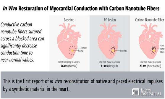 美国动物研究证实，新材料可重建心脏传导系统