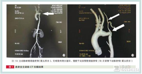 【阜外疑难病例】一位误诊为围产期心肌病的女士