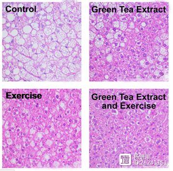 得了脂肪肝怎么办？美动物研究称，绿茶 规律锻炼或有效