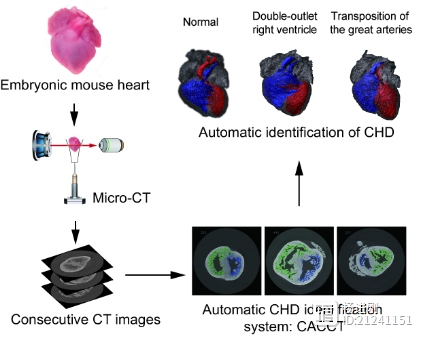 胡盛寿院士团队研发出先心病模型表型全自动鉴定“利器”：5分钟内搞定，准确率与20年小儿心外经验的高年资医生相当
