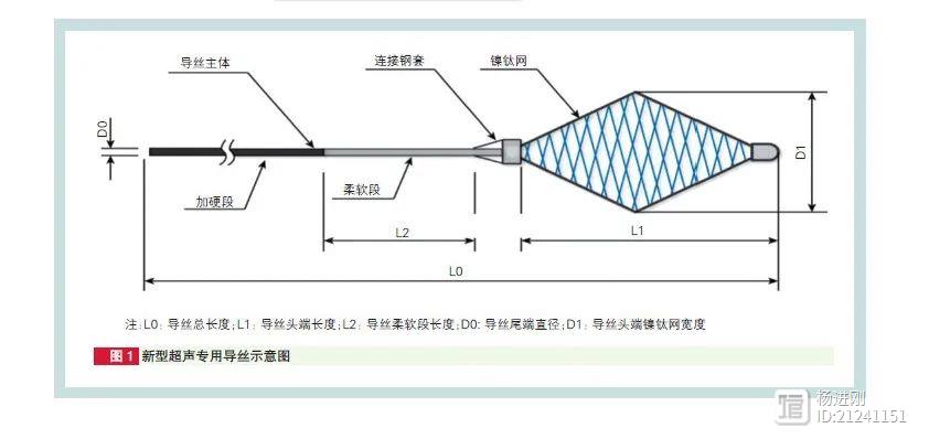 让不开刀、不用射线治先心病更容易！阜外医院潘湘斌等研发出新型超声导丝