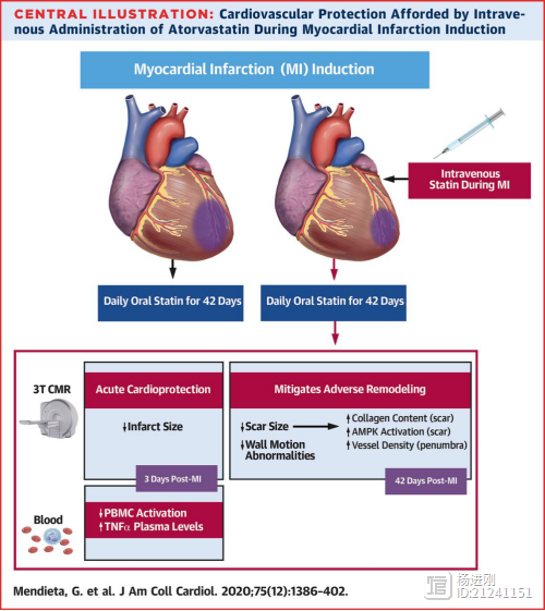 心梗患者应该静脉给他汀！JACC西班牙动物实验