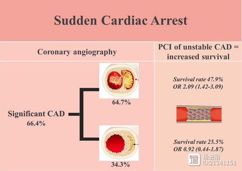抢救心脏骤停患者，仅不稳定病变可从早期介入治疗中获益！Circulation子刊研究