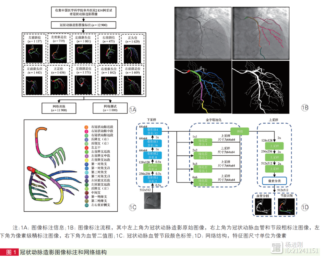 机器学习读冠脉造影片可行可靠！阜外医院徐波等研究