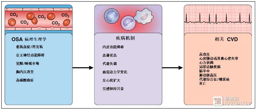 有心血管病，该查“睡眠杀手”！美国心脏协会睡眠呼吸暂停声明