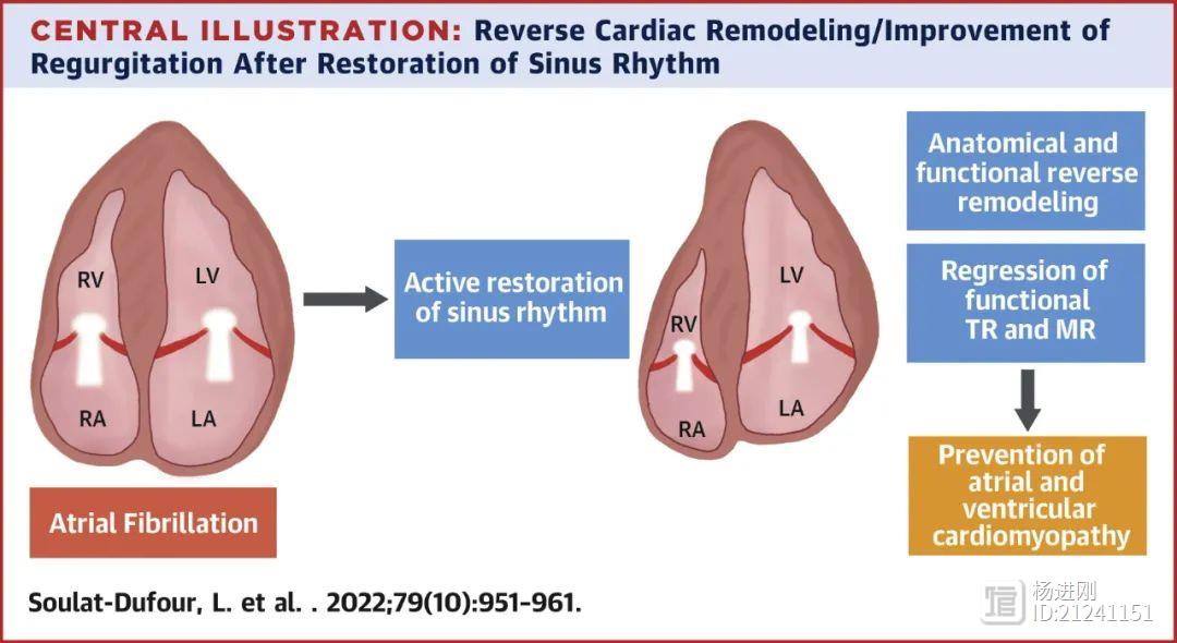 有房颤，积极恢复窦律或可逆转心房重构！JACC研究