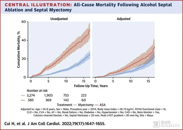 治疗肥厚梗阻性心肌病，酒精消融还是外科手术？JACC阜外医院等3家中心近4000例患者分析