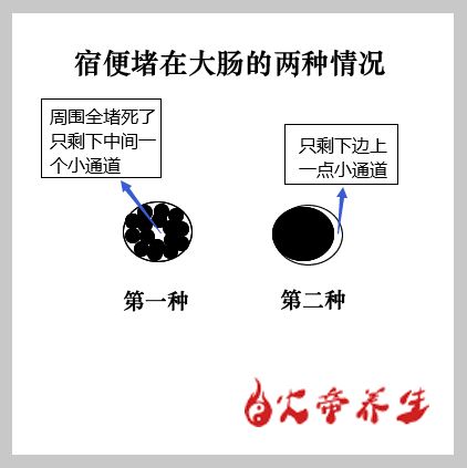 倪海厦金匮要略笔记（三三四）呕吐哕下利病脉证治第十七/大承气汤