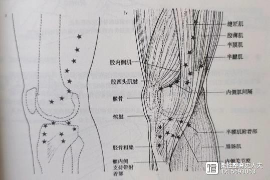 膝关节不同部位压痛点的寻找方法(四)