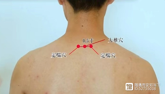 定喘《常用新医疗法手册》师承笔记