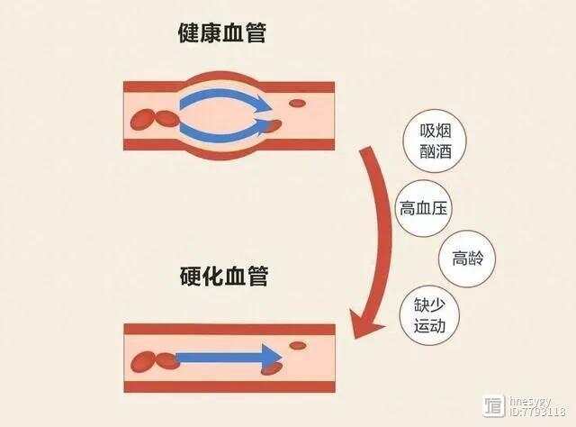 记住这4个维生素，血管可能变得更健康1、维生素B，降低胆固醇，预防斑块2、叶酸，平稳血压，降低血液粘稠度3、维生素D，降低心脑血管患病风险4、维生素C，进血液循环补充营养