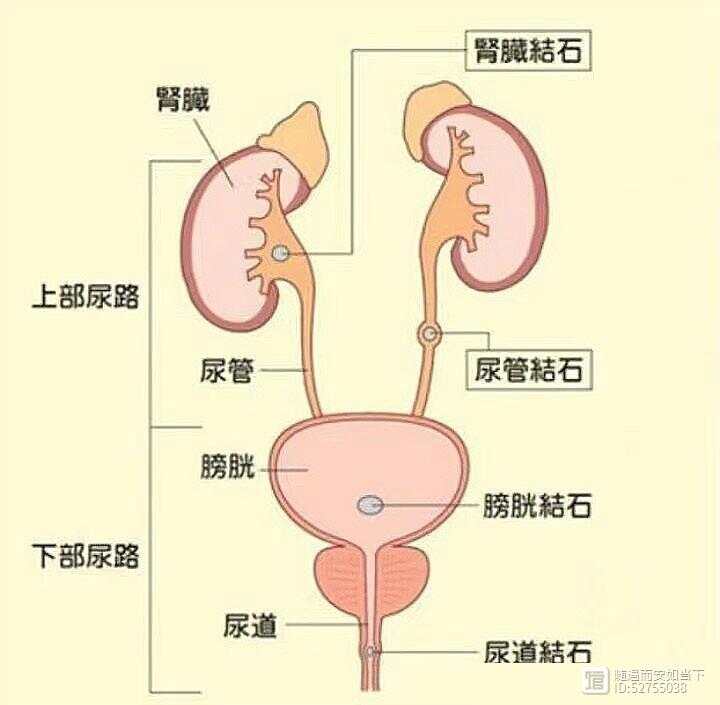 尿石症  师承笔记