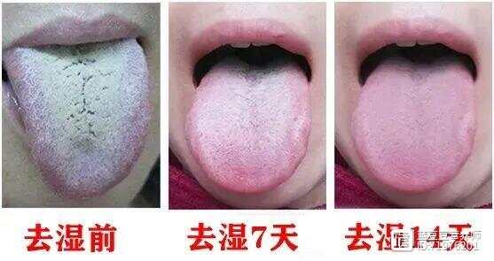 一个中药减肥奇方，健脾、渗湿、降脂，调理肥胖症！