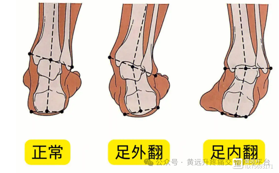 膝关节蹲下疼痛（2）