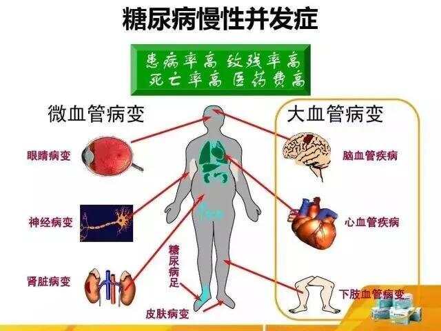 糖尿病并发症的16个危险信号，你占了几个？糖尿病并发症到来之前，