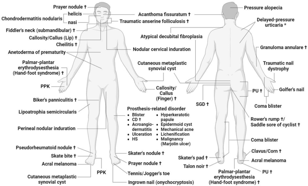 皮肤受压引发的 13 种疾病，你了解几种？