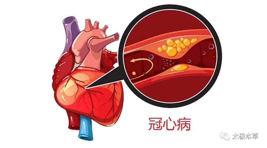 冠心病、心律失常、心绞痛，不用怕！咱老百姓有验方